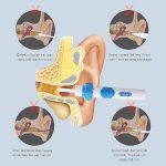 earsio