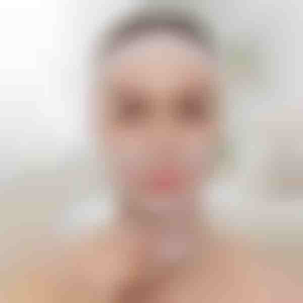 Traka za podizanje i oblikovanje lica | KIMLIFT